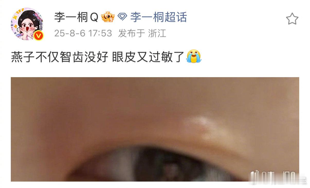李一桐蜜蜂小狗预备役李一桐智齿没好眼皮又过敏了近日，透露自己智齿没好眼皮又过敏