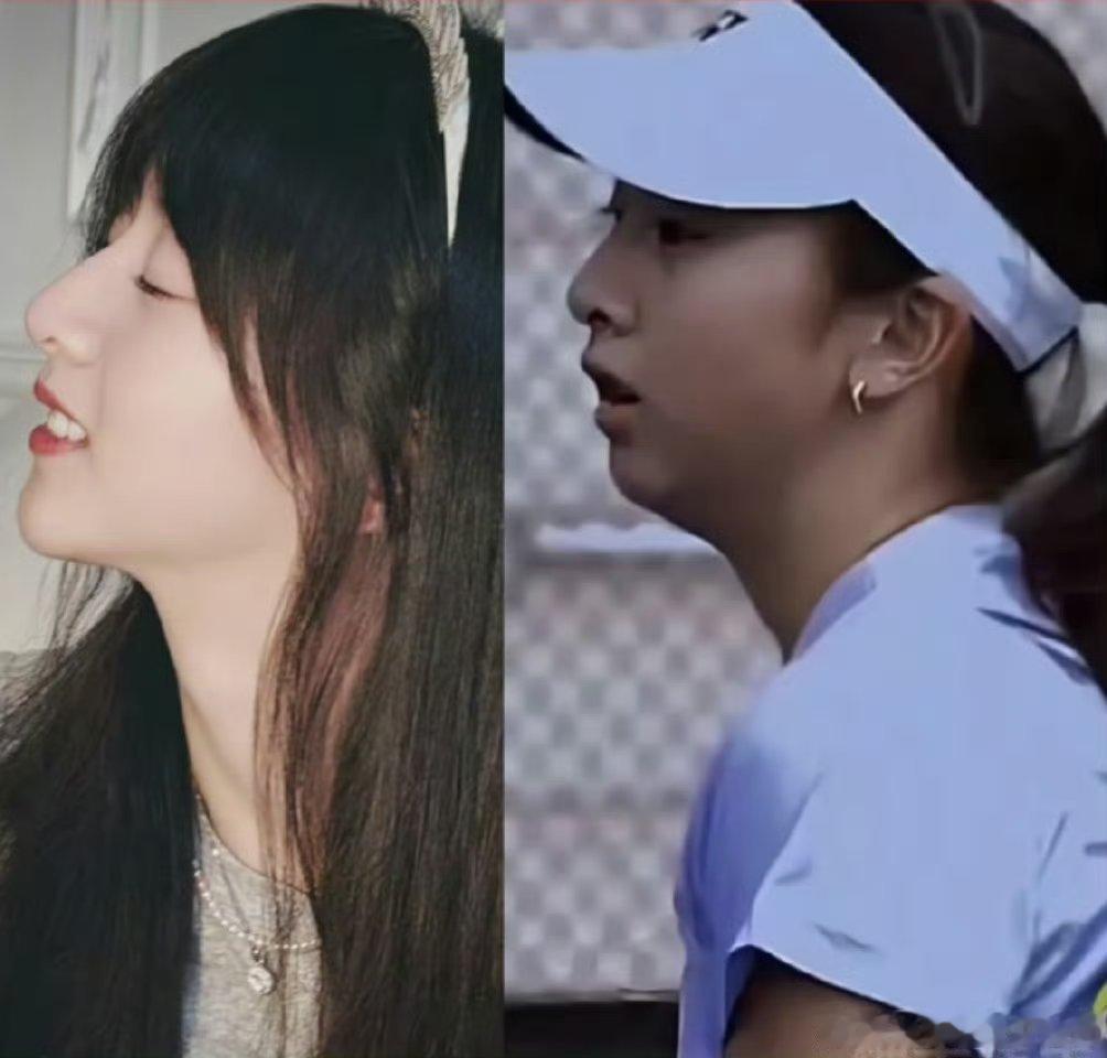 森碟17岁生日照太美了吧，下巴菱缩矫正一年后，再看脱胎换骨，这个年纪的小女孩美到