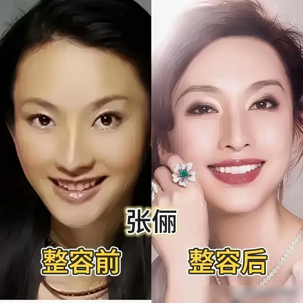 全网扒了十年沈梦辰整容，居然没人拿到实锤？网友把她出道旧照和近照对比，从面部轮廓到鼻子眼睛，列了满满