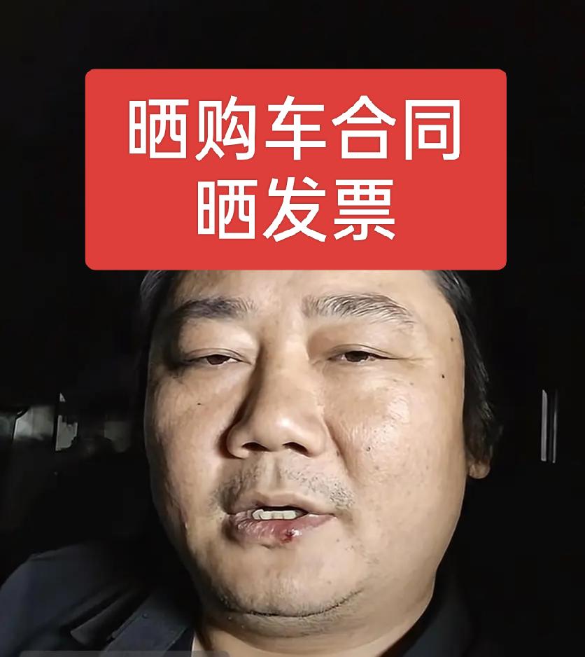 张雪还是技高一筹，直接给韩红基金会支招，把买车的相关购车合同和发票晒出来，直接就