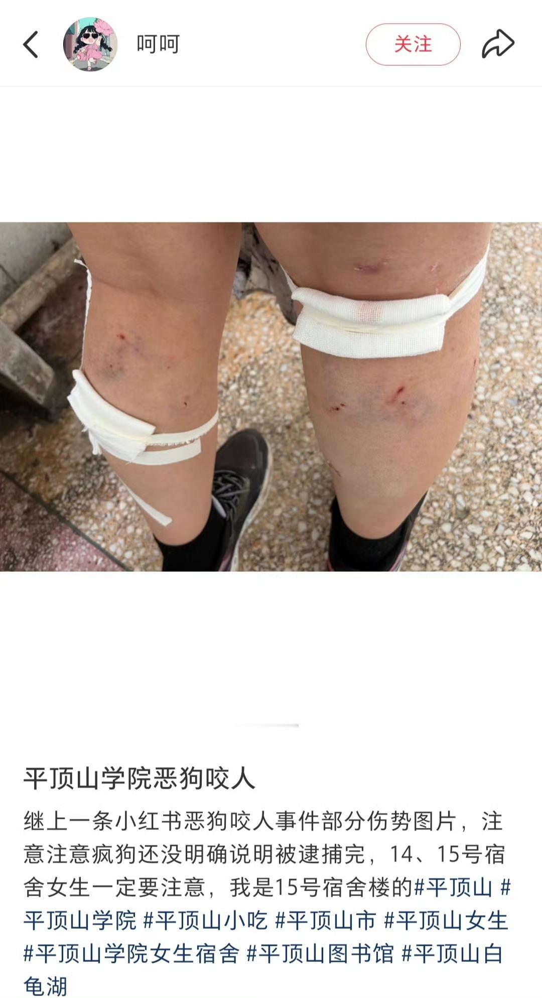 女生称在校园被狗围攻咬伤回旋镖来咯前情提要：2024年平顶山学院两个保安因为清理