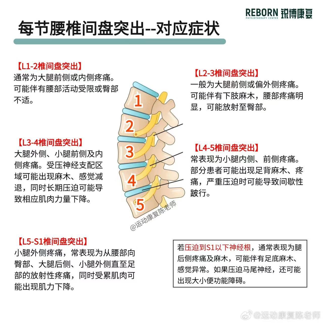腰椎间盘突出继续来讲讲腰突症状，不同腰椎间盘的突出，引发疼痛的位置、神经症状、