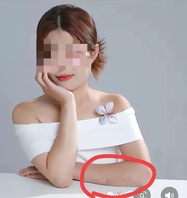 这是河北沧州被家暴女子之前的一张照片，她胳膊上有一道很长的疤痕，为此她的弟弟以及