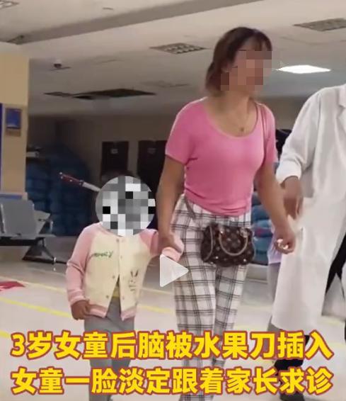 猛一看以为特效！一宝妈深夜哭着拉孩子看病，原来小孩头上插了一把水果刀，万万没想到