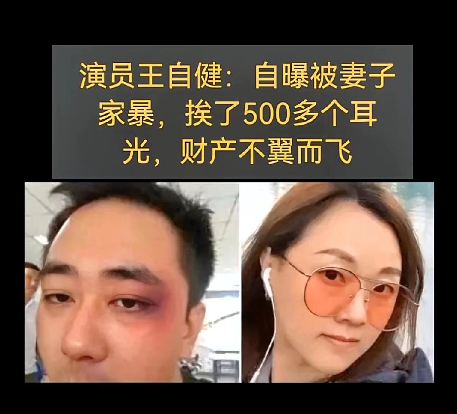 王自健的家暴真相：别让段子掩盖了真实的伤痕当年，王自健因为说错话，被妻子打