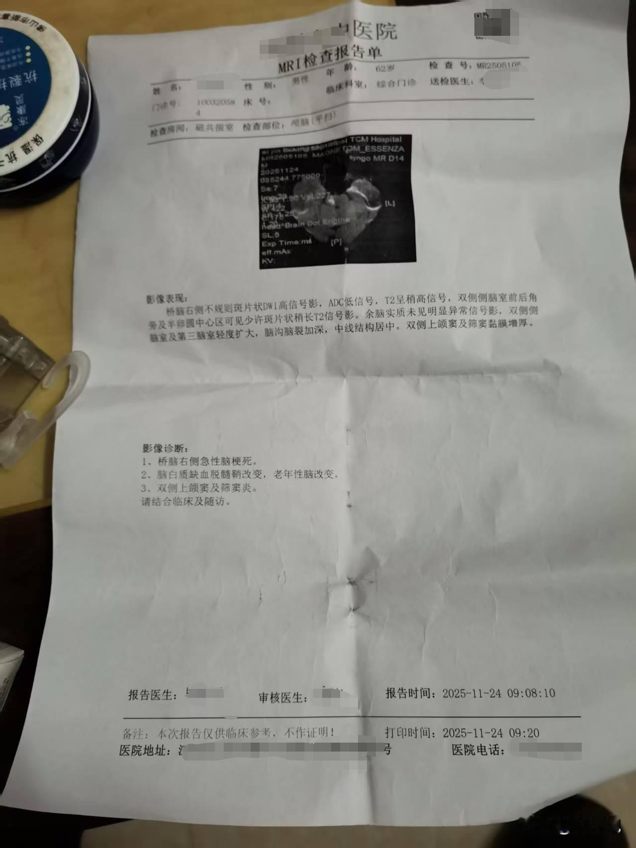 我爸急性脑梗死好几天了，就是不肯去医院住院。从19号发病，感觉头重脚轻，走路