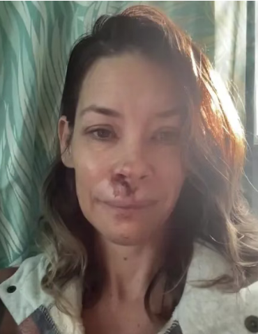 “黄蜂女”突然自曝, 大脑受损, 认知能力下降, 经常无故昏迷