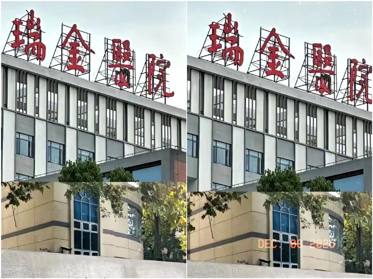 上海最牛的瑞金医院，牛到什么地步？​​刚做完手术才第二天，就被医院“请”出院