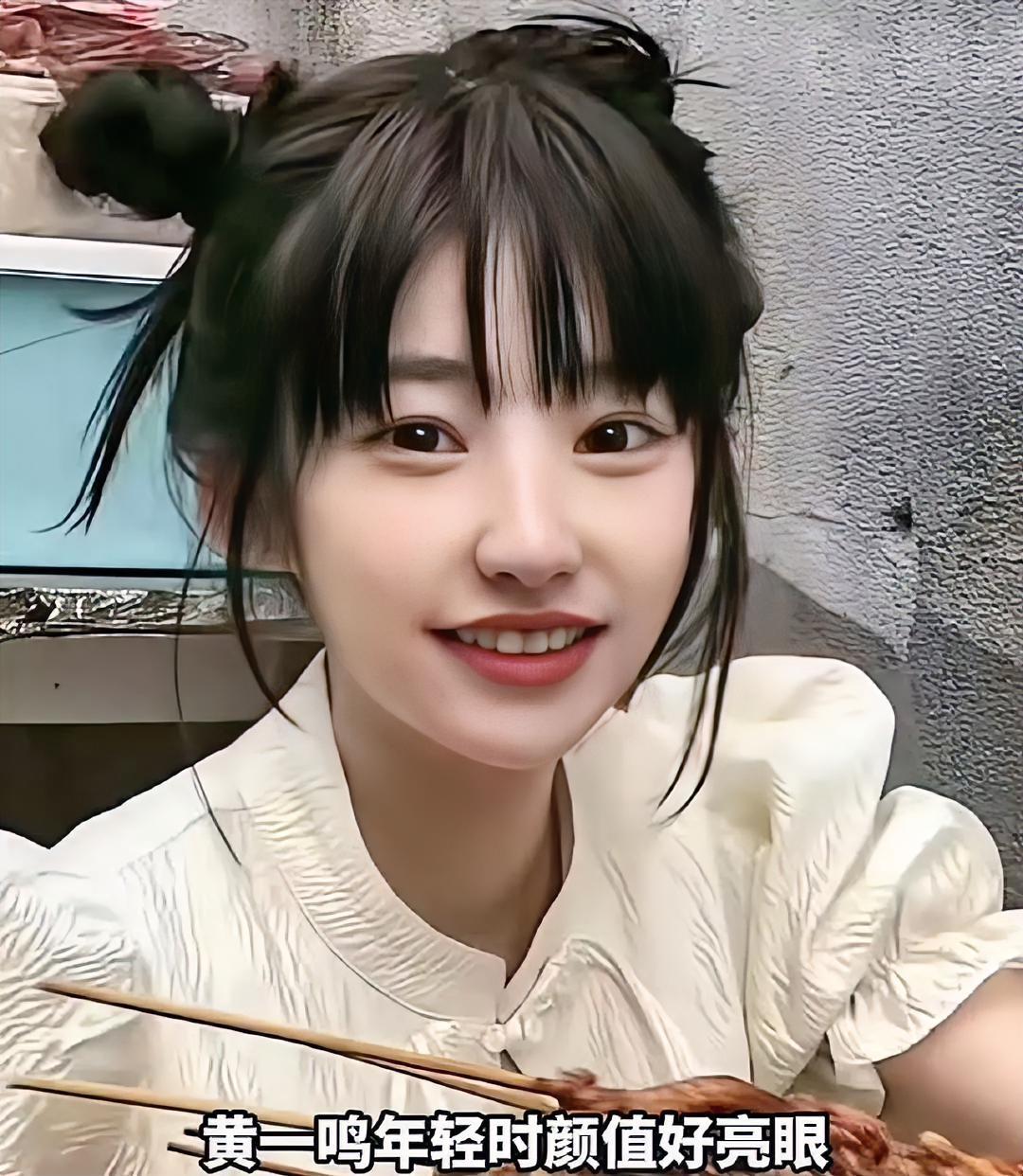 黄一鸣这下巴整得，居然敢直接晒成果？大方分享整后状态，直言下颌线更明显、侧