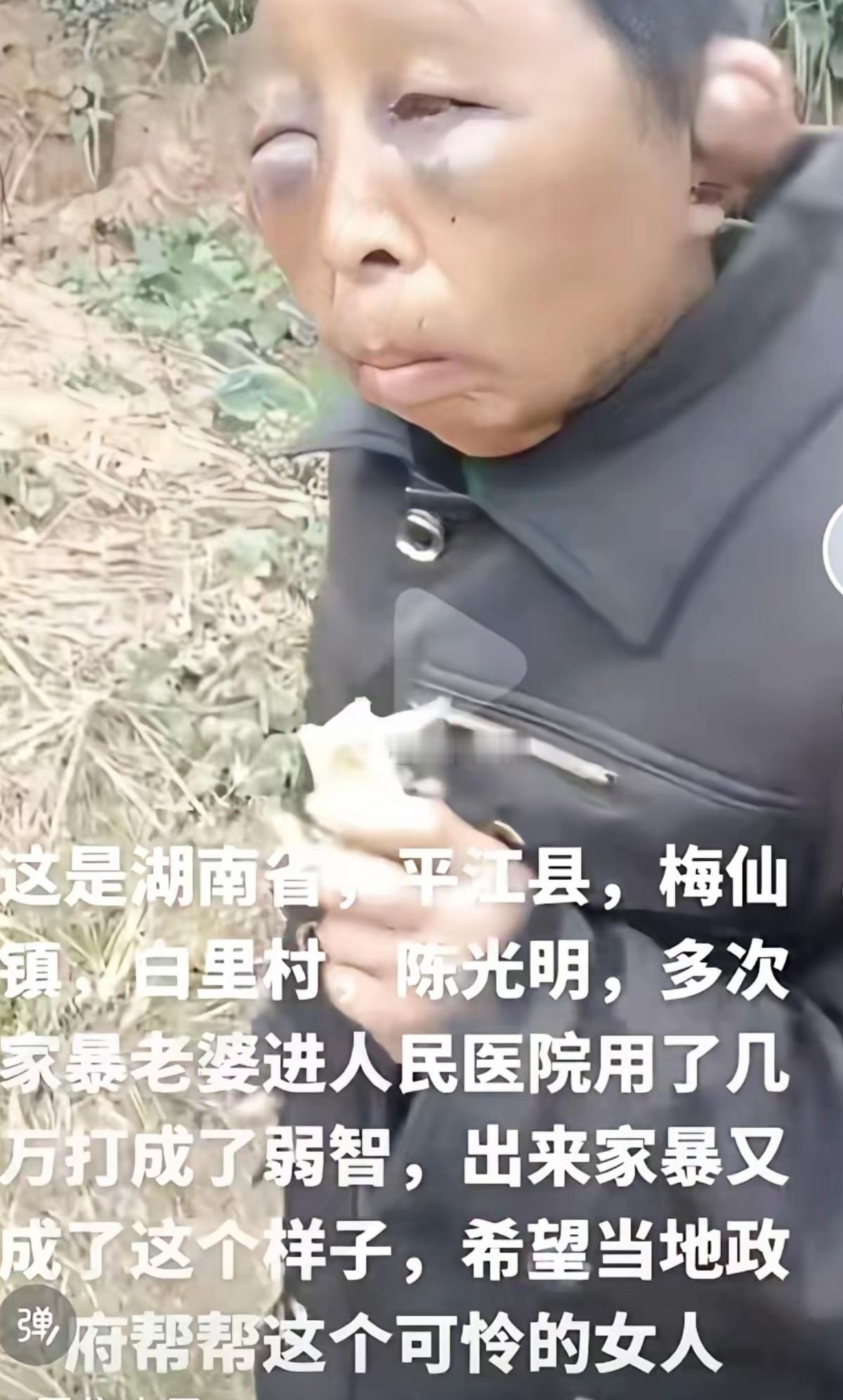 家暴是零容忍，绝不给机会，动手打过你的男人，绝对不原谅！家暴家暴违法行为家暴