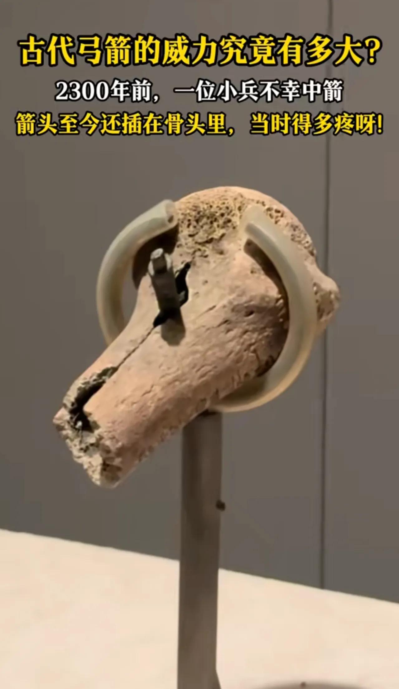 不容辩驳，弓箭就是古代的大杀器！2300年前，一个古代的士兵，被弓箭一箭射穿骨