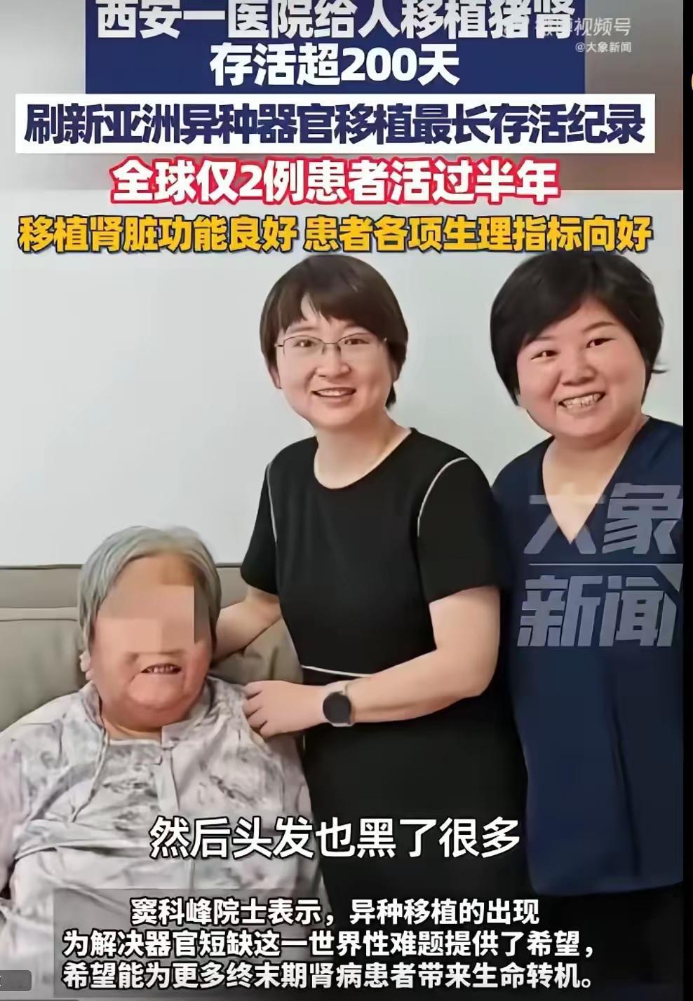 这下出名了，不知陕西西安，全国人民都知道了！陕西西安一个医院给人移植猪肾存活