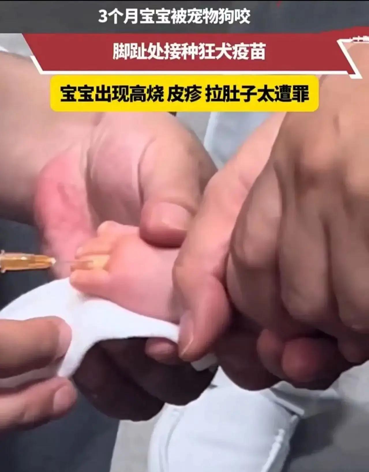 “这次养狗的后悔了！”就因为家里养的狗“吃醋”，才三个月大的宝宝，硬生生遭了半条