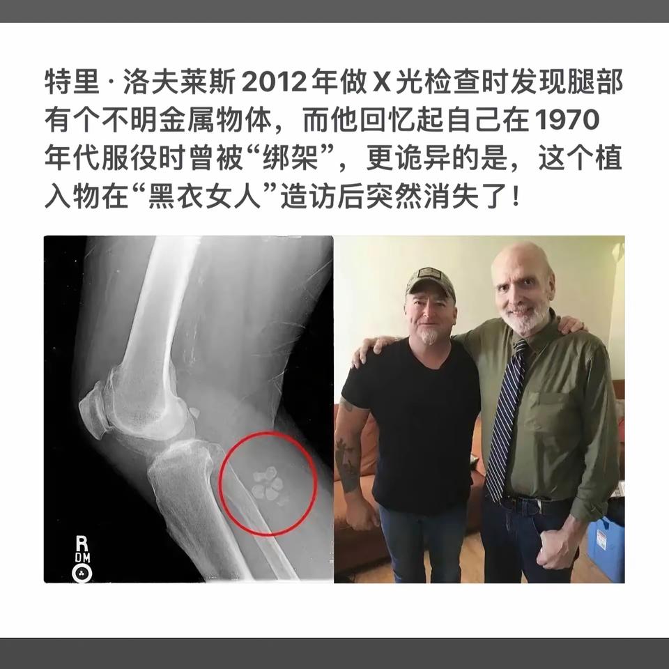 1970年服役时被“绑架”，2012年X光检查时突然出现！