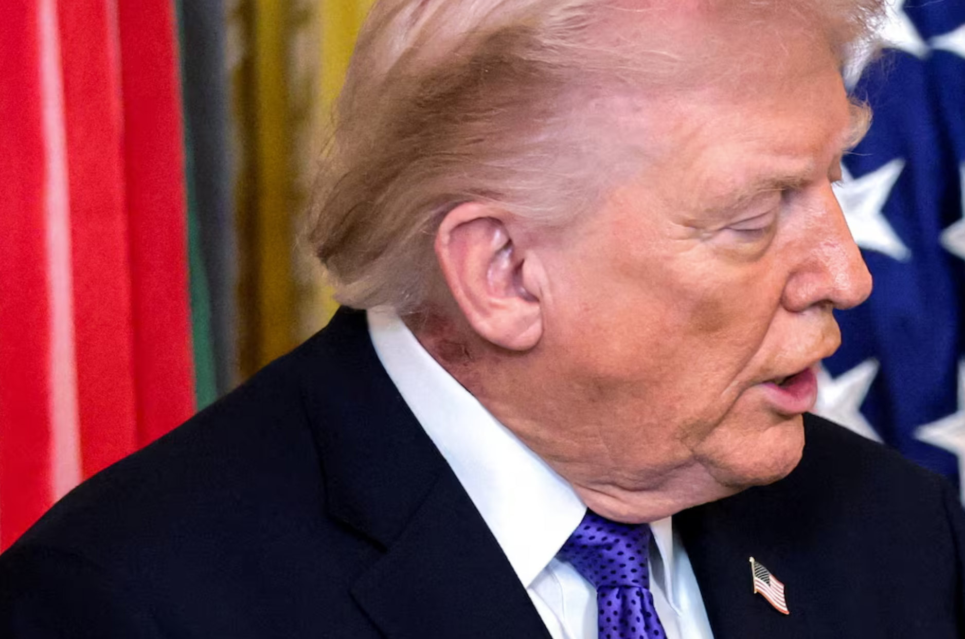 【#特朗普脖子上发现红色皮疹#，白宫：正接受治疗】据路透社消息，当地时间3月4