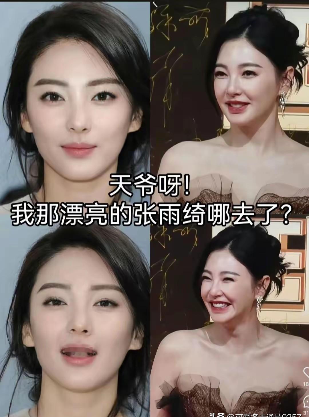 她一张嘴，我就知道坏事了。不是台词问题。是她的脸，动不了了。最近刷到张雨绮