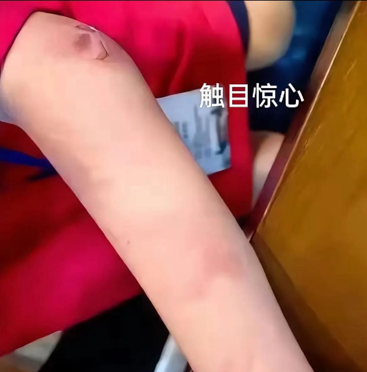 他是300多名六段业余选手中唯一的小学生，是最年轻的围棋选手，曾经是浑南杯的冠军