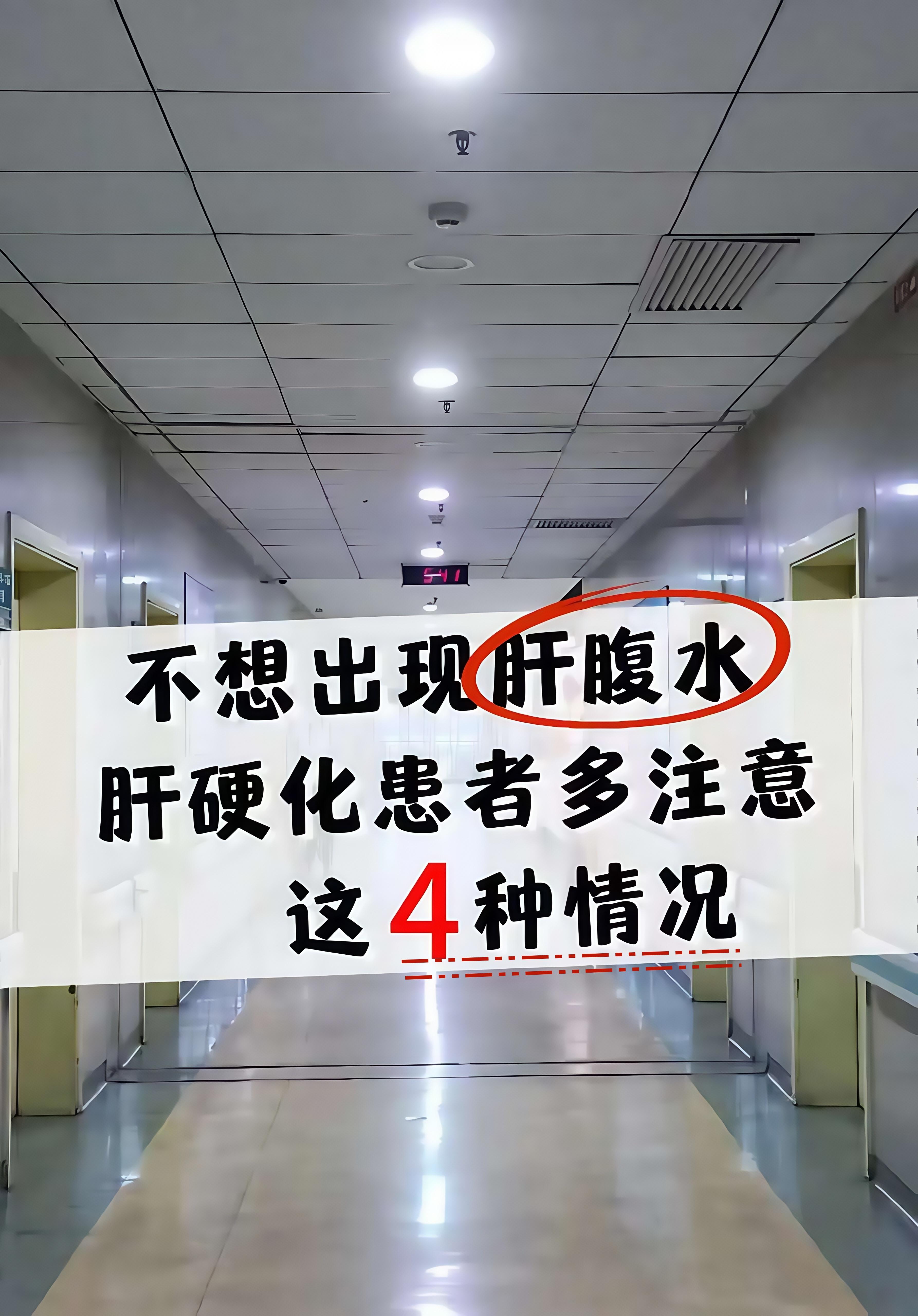 肝硬化患者注意这4种情况，当心肝腹水！ 1. 浮肿。肝腹水在早期会出现...