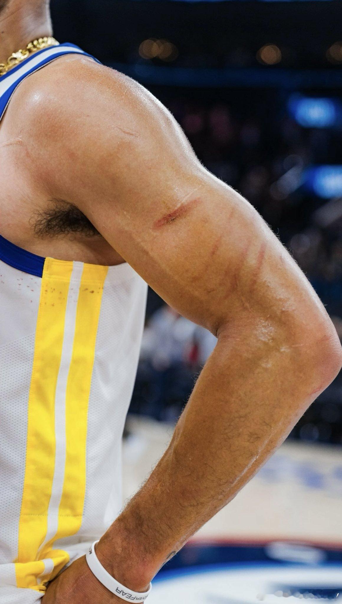 一场下来，非常残酷。