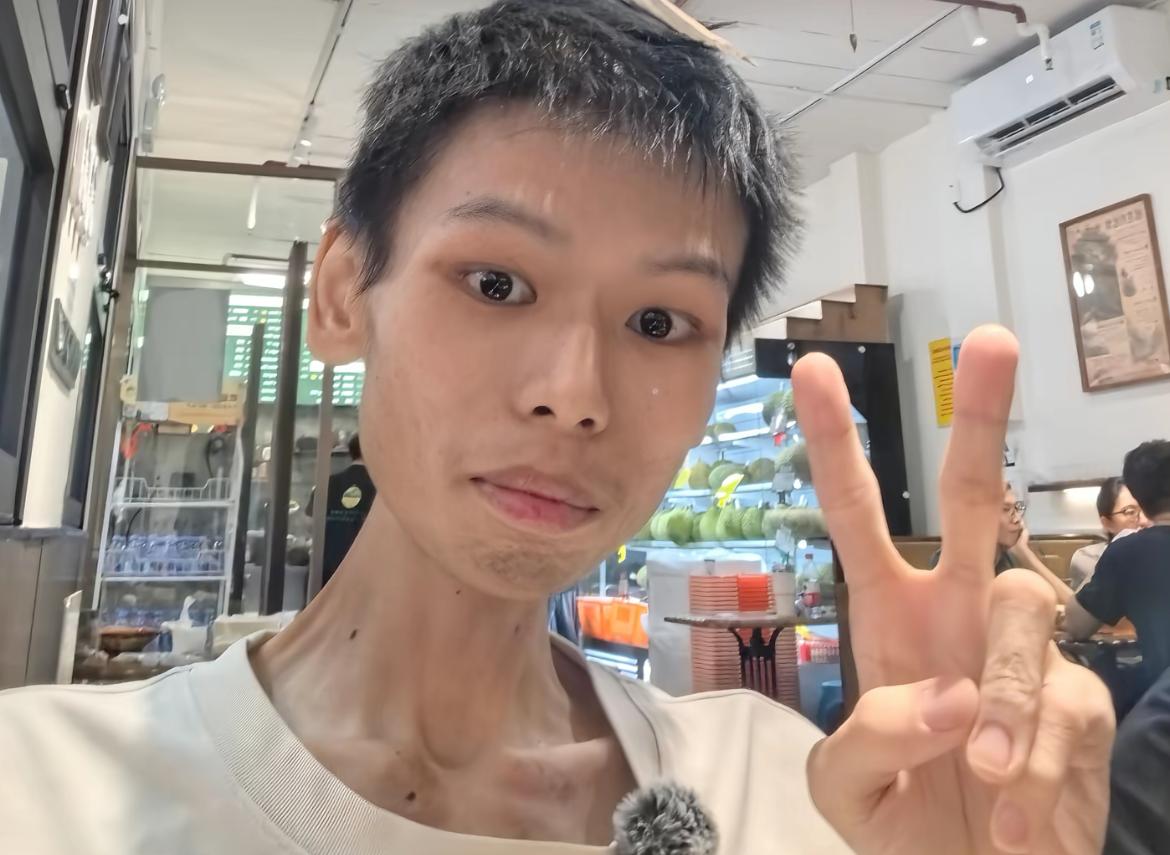 广东珠海24岁帅哥詹志炜去世，年仅24岁，疼到彻夜难眠，曾劝网友不要熬夜，一定要