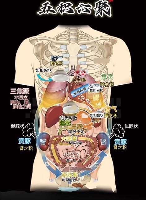 五积六聚藏于身！老中医手绘图揭穿“积”病真相：三焦不通，百病皆生大家好，我