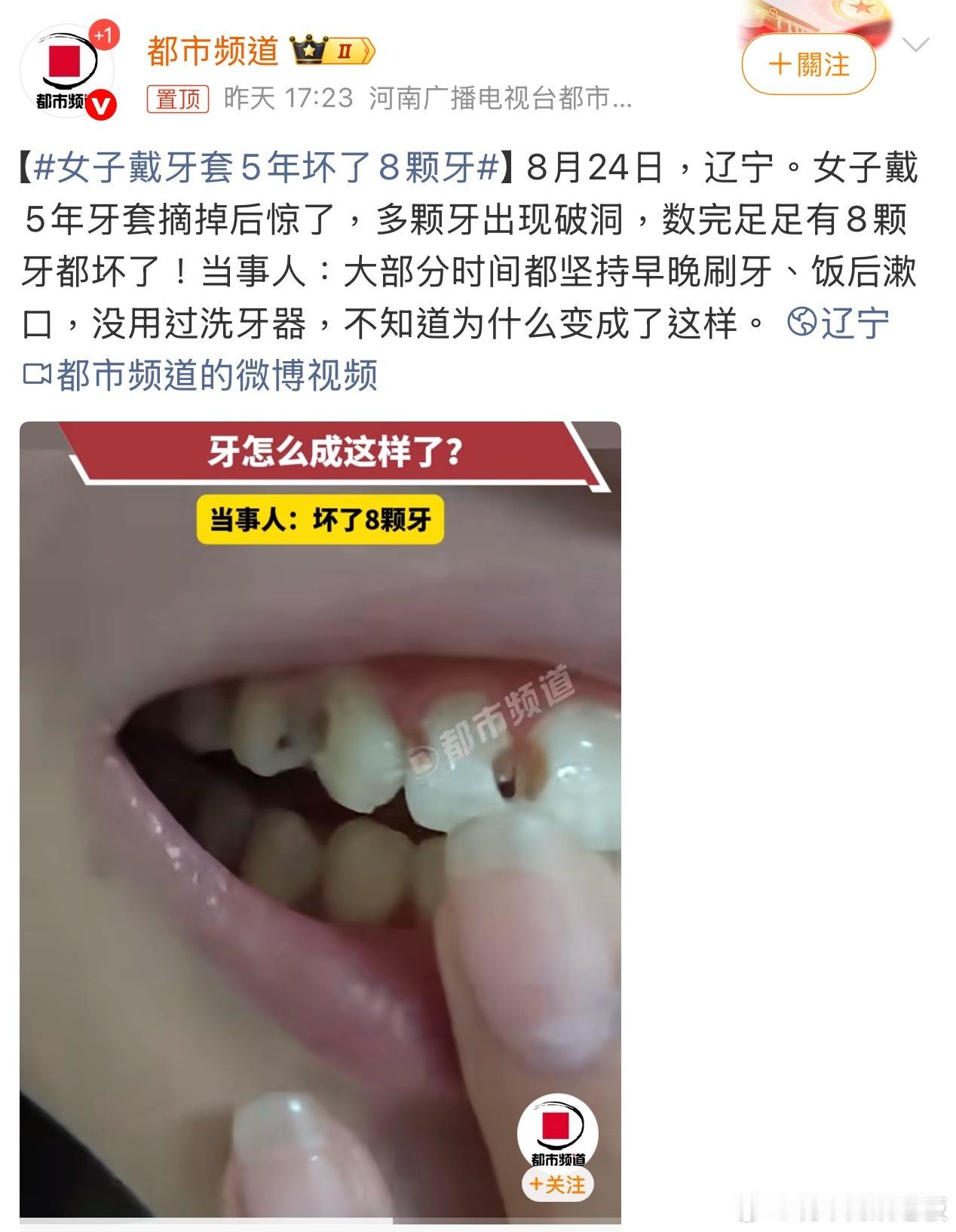 女子戴牙套5年坏了8颗牙整牙不是小事，从选机构、挑医生到后期护理，每一步都不能