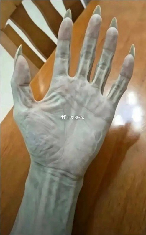 洗个澡手就变成这样了，有什么解决办法吗？
