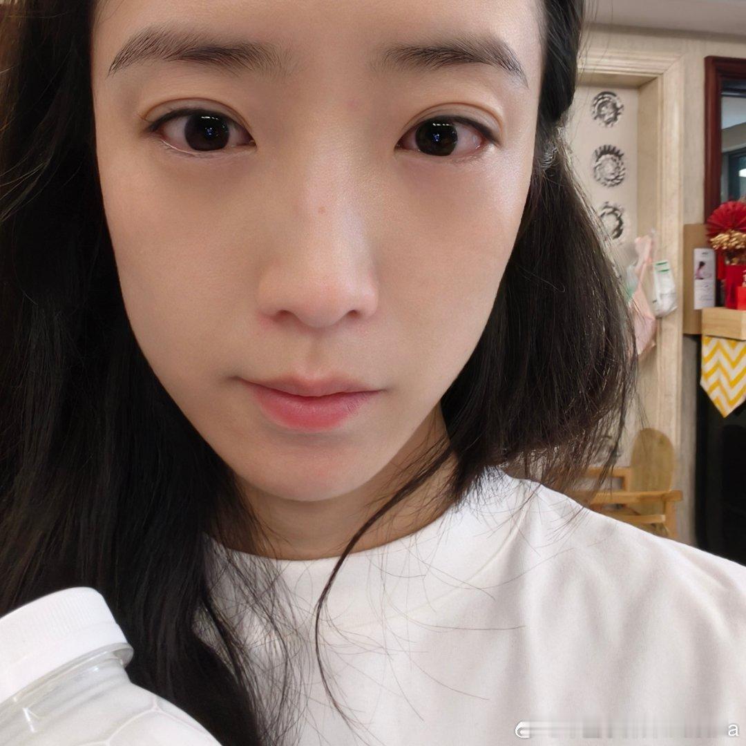 过敏体质真的是特别困扰，小时候的哮喘，现在的鼻炎皮炎，结果昨天开始又喜提了个结膜
