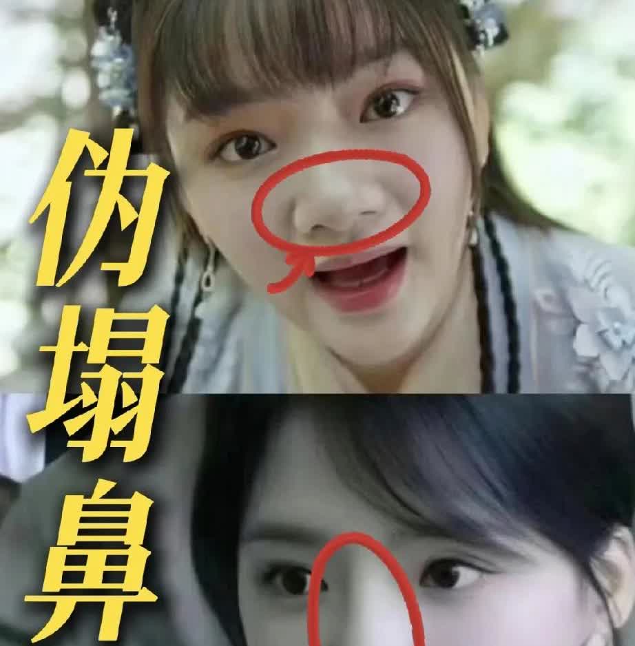 你以为自己鼻子塌？其实是被它骗了！任敏的鼻子一直被人诟病，其实她不是鼻子塌