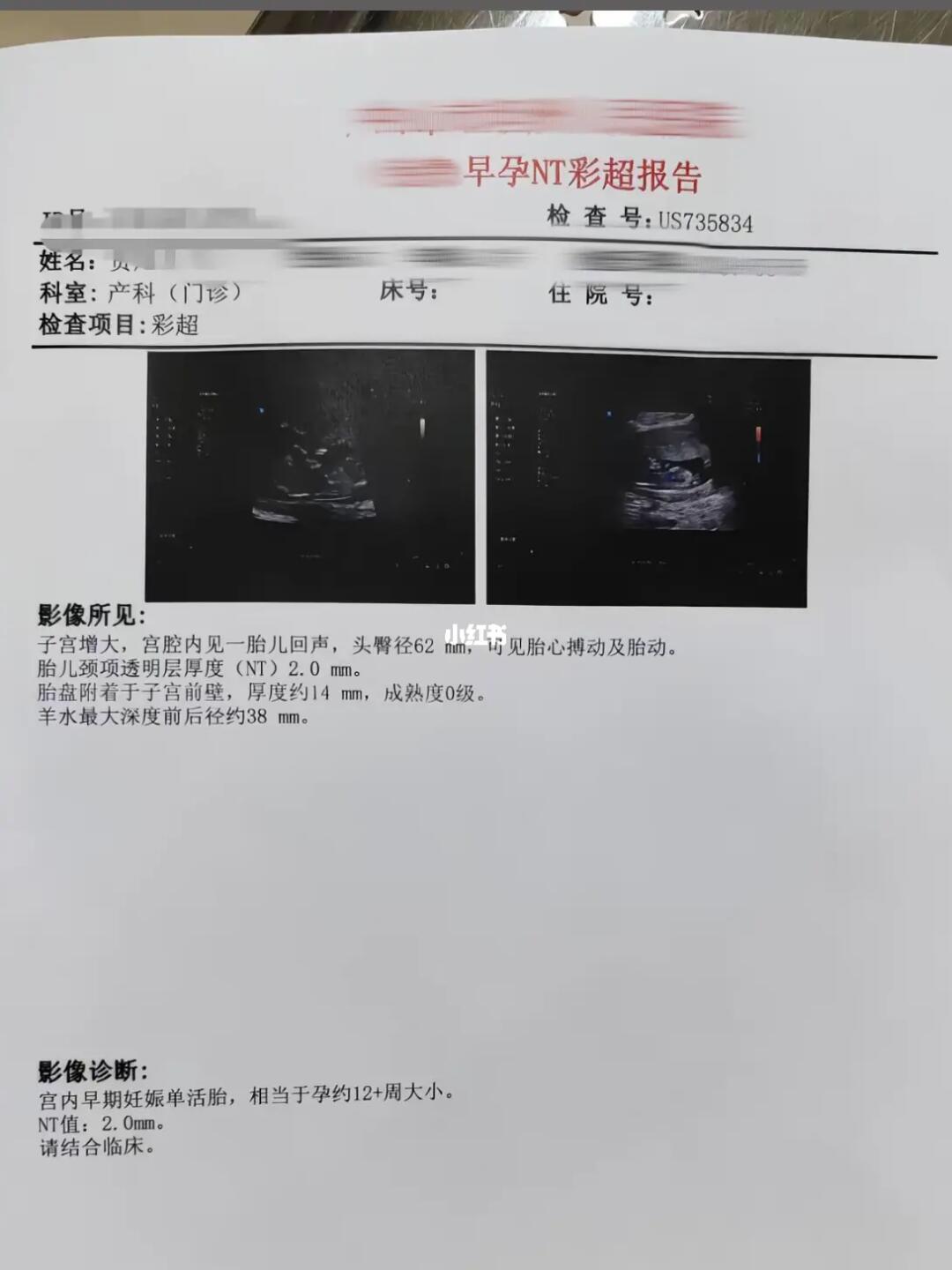 听说好孕会传染，下一个接力棒会是谁呢