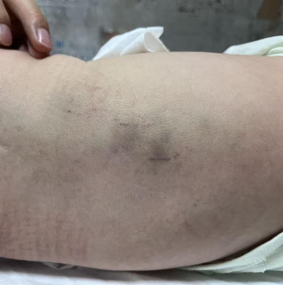 丧尽天良！9月22日报道，陕西咸阳一位宝妈产后感冒，怕传染宝宝，在月子中心建议下