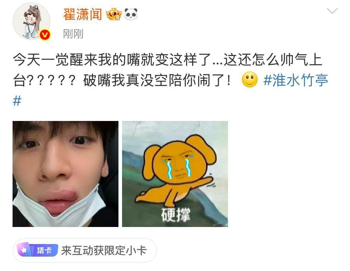 翟潇闻肿成香肠嘴翟潇闻破嘴我真没空陪你闹​翟潇闻肿成香肠嘴哈哈哈哈哈这是怎么