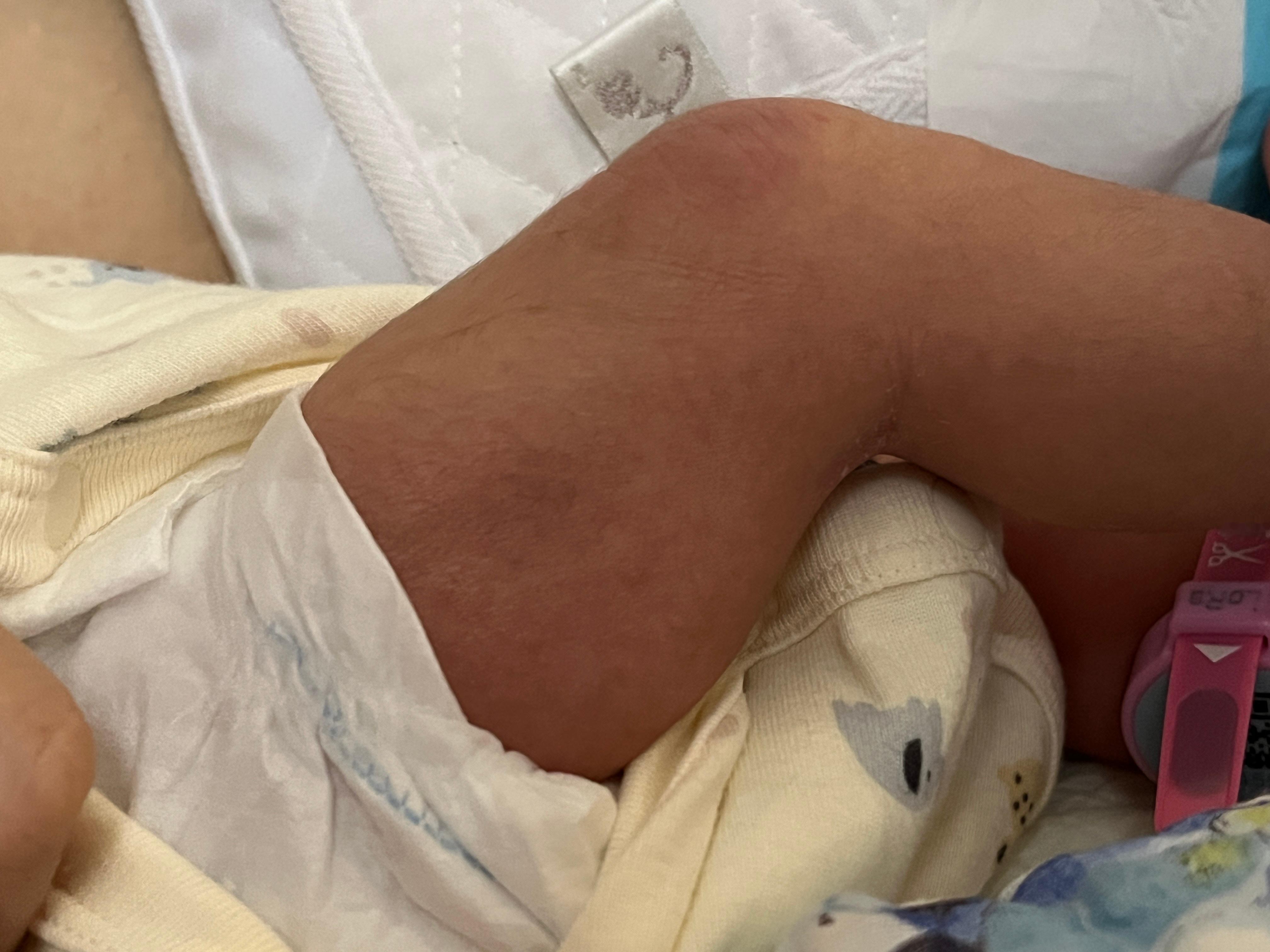 这小子在娘胎里就整天拳打脚踢，胎动超级活跃。产检的时候问医生，医生说：“好啊，练