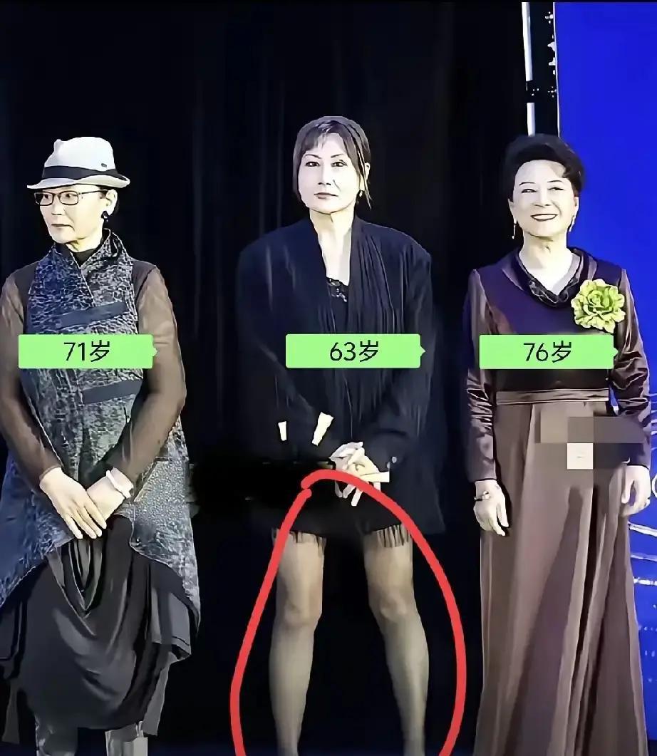 那张让张凯丽被全网骂“不得体”的叉腿照，恰恰戳破了我们对“老艺术家”的最大误解。