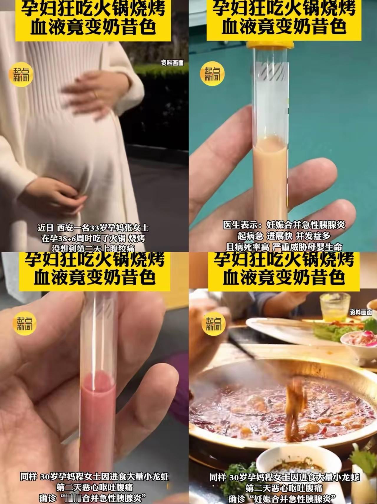 一觉醒来，怀孕的准妈妈们都沉默了！近日，西安的张女士已经怀孕38周，因为突然腹痛