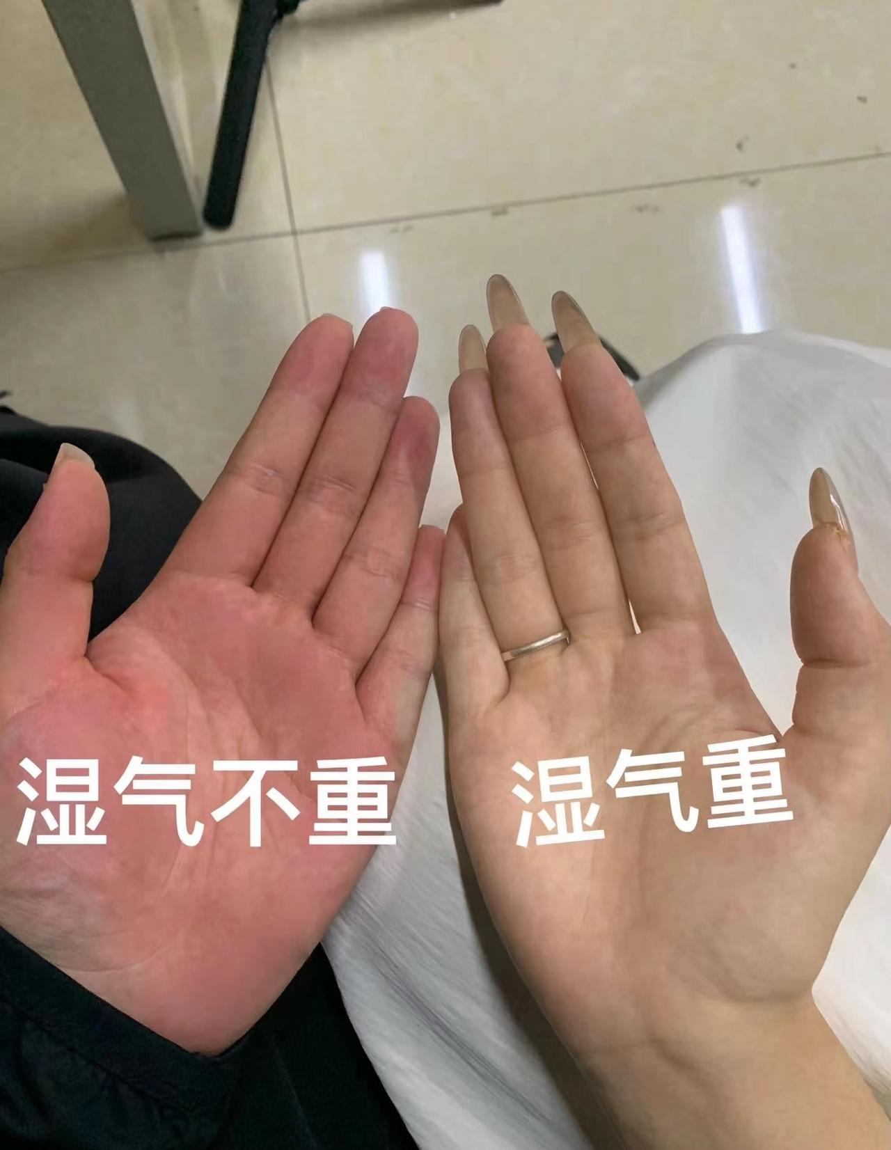 自律一个月，湿气全排空！瘦10斤、脸不油、浑身都轻松！总瘦不下来？脸爱出油？