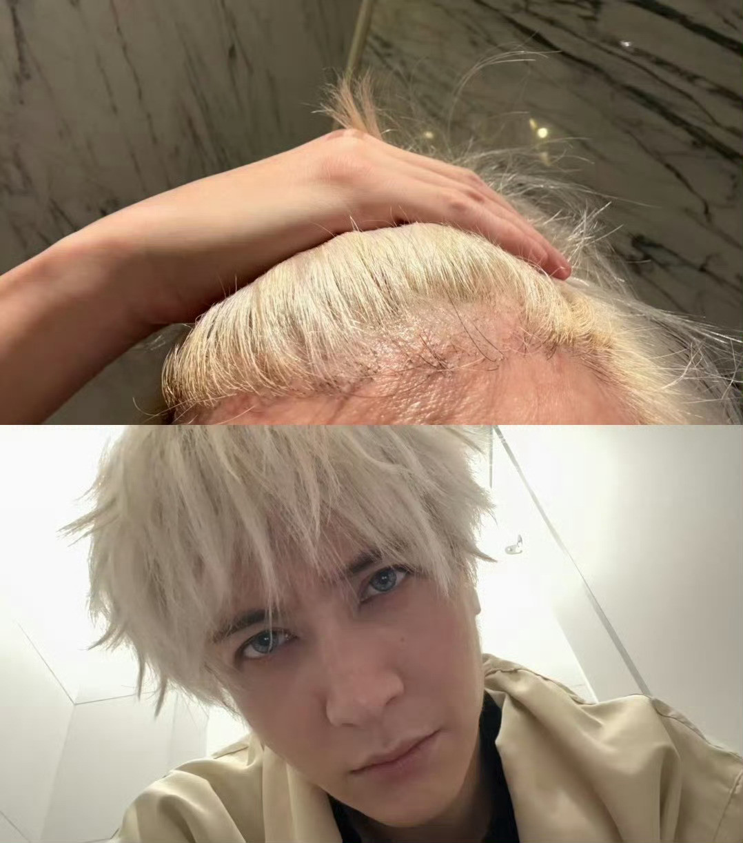 薛之谦满头斑秃和水泡以为是hei粉说的，没想到“满头斑秃和水泡”是他自己的用词?