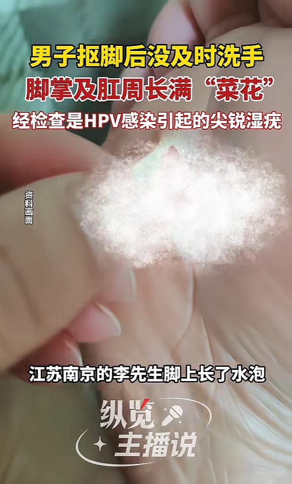 “悲剧还是发生了！”江苏南京，一男子脚上长了水泡，用手抠破后，伤口处竟然长出“菜