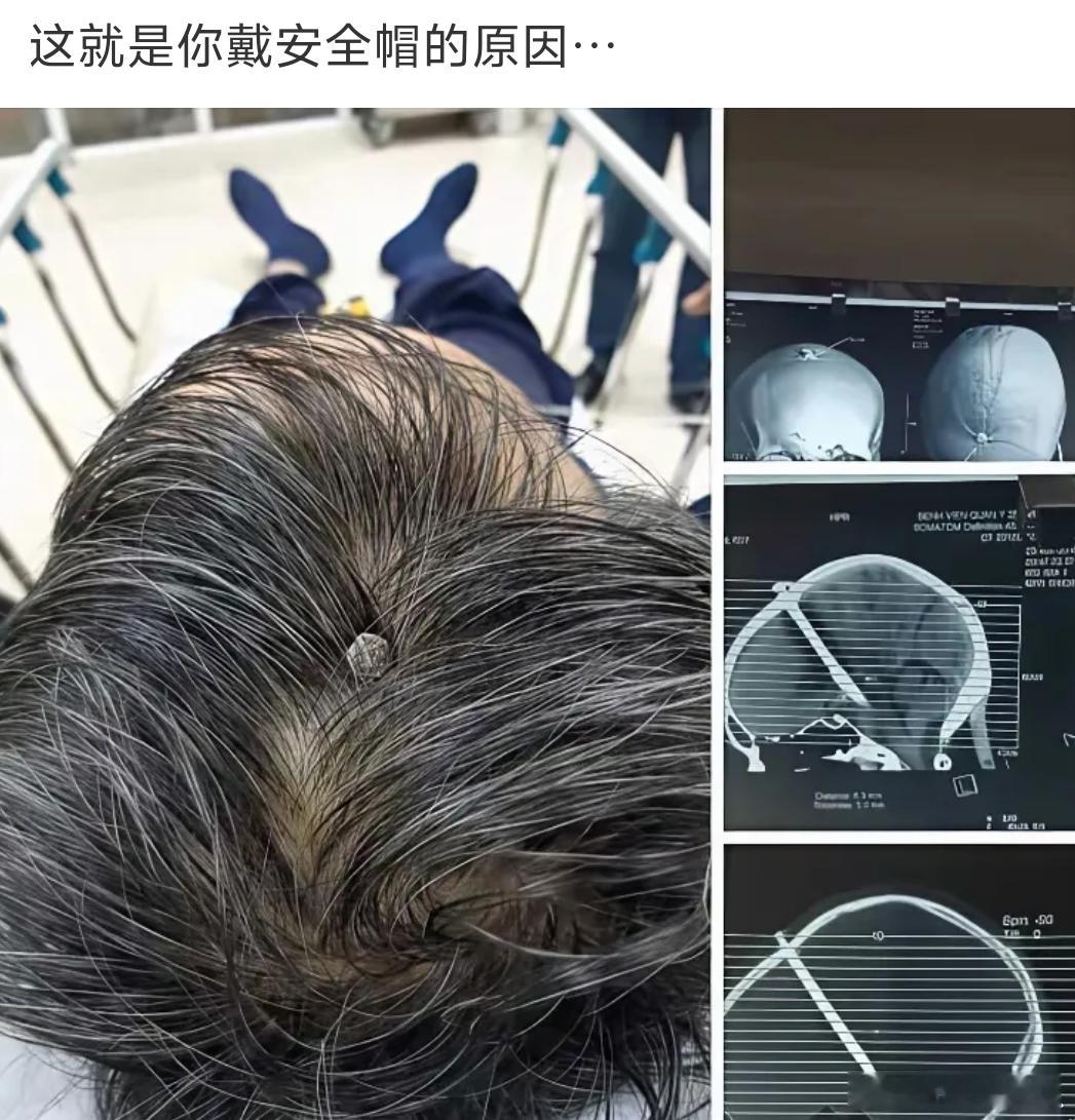 这就是让你戴安全帽的原因。​​​