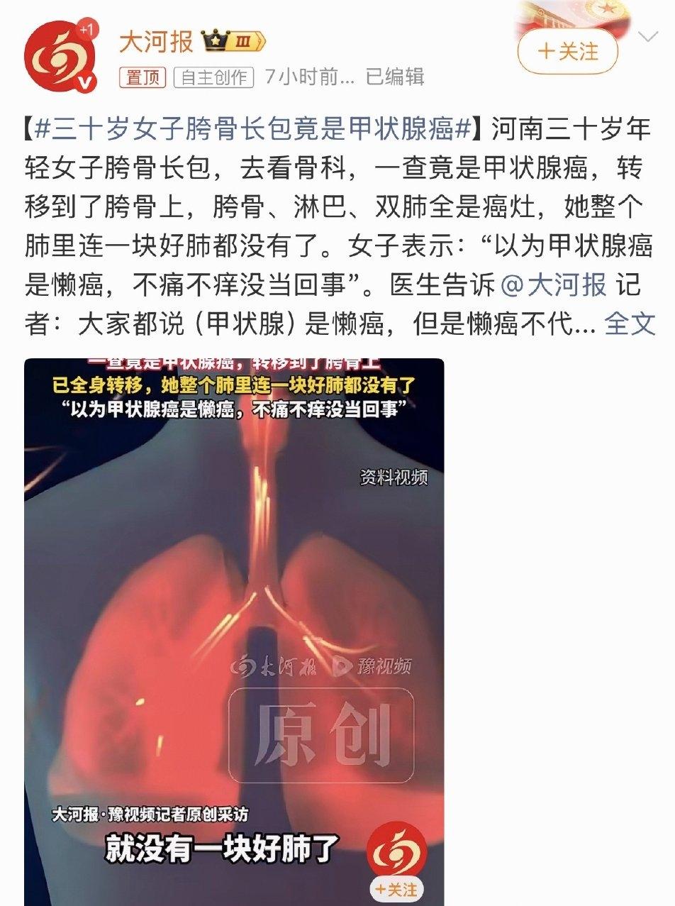 该患者最初发现胯骨处无痛性硬质包块，原以为是骨科问题，检查后却确诊为甲状腺癌晚期