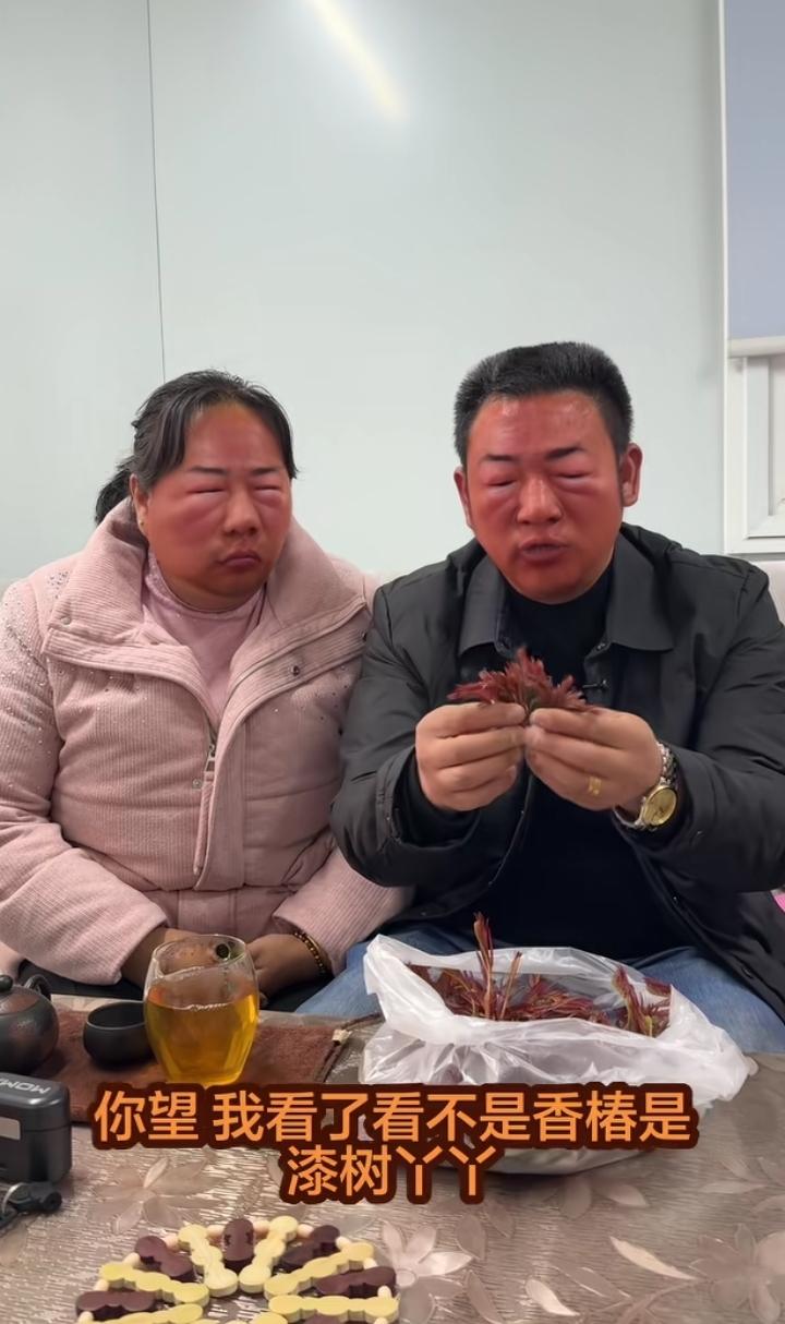 漆树芽当香椿吃了，夫妻俩脸肿得像捅了马蜂窝，压根不用打码，也看不出谁是谁。近期