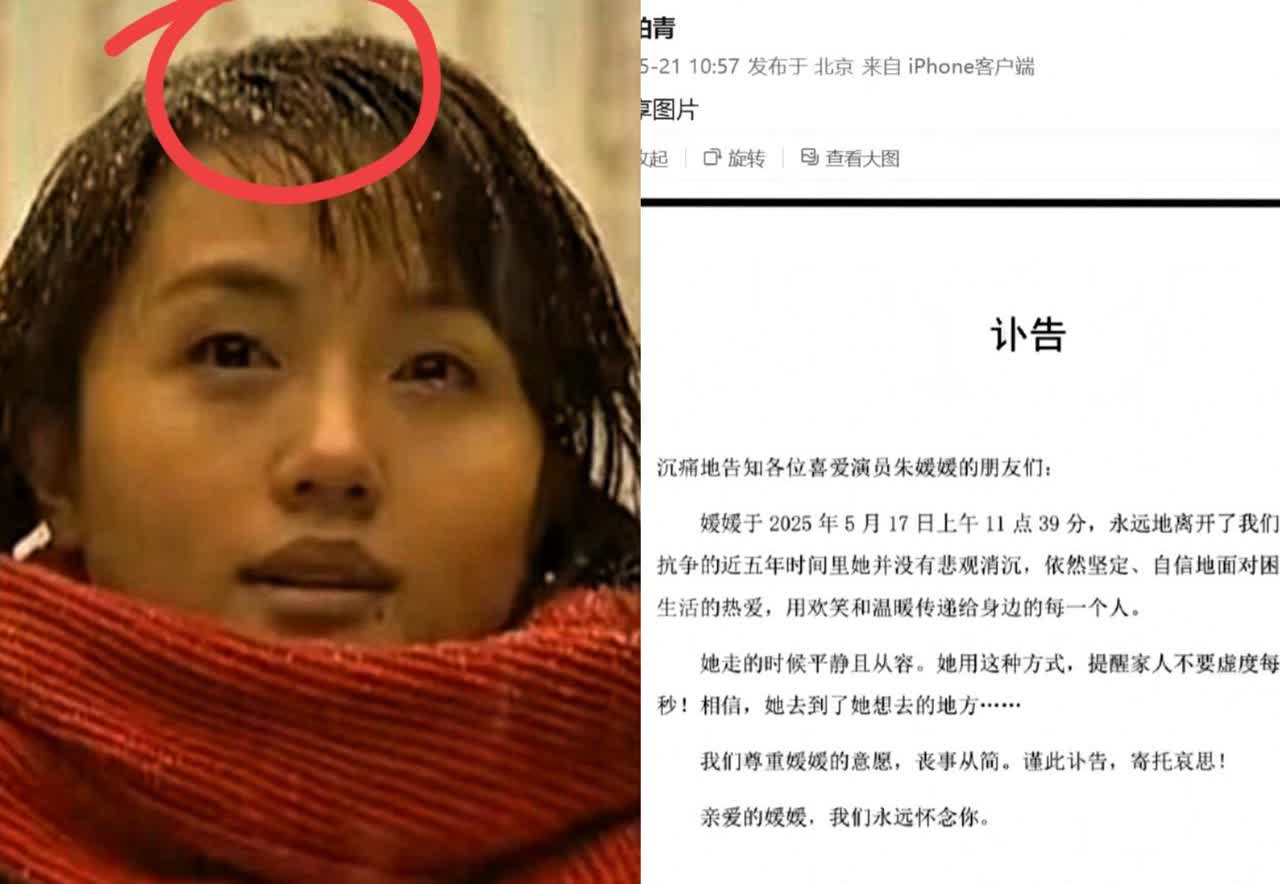 朱媛媛，太拼命了！2020年查出胃癌，依然拍了11部戏。医生建议她做切胃