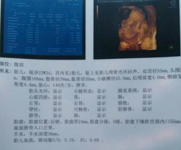 1月5号预产期, 29号卸货小公主, 附16条详细孕期症状