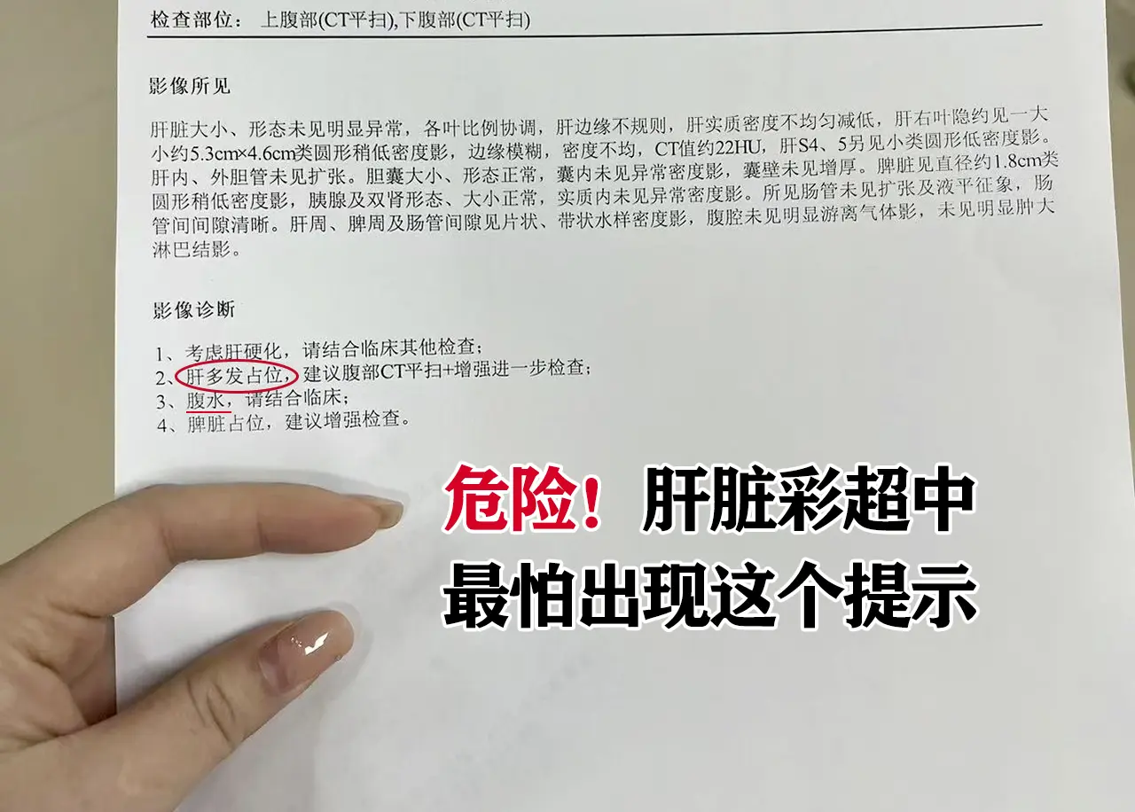 这位患者才50出头，肚子胀得像个皮球，脸色蜡黄，整个人瘦得只剩骨头。C...