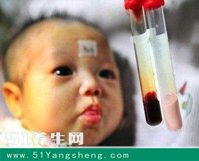 这4类女人不能生男孩, 只因这些疾病传男不传女, 赶紧分享给身边人!