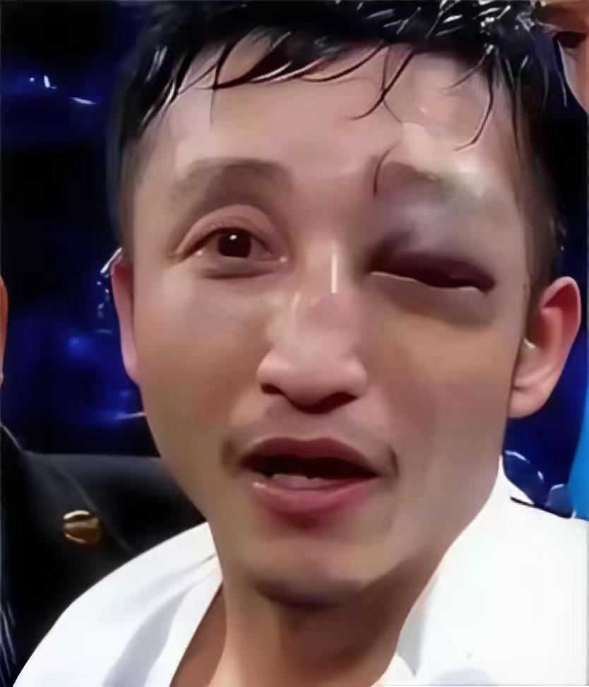 拿命拼来的2亿身家，愣是在商场败了个精光，邹市明这步棋，走得太让人心疼！拳台上左