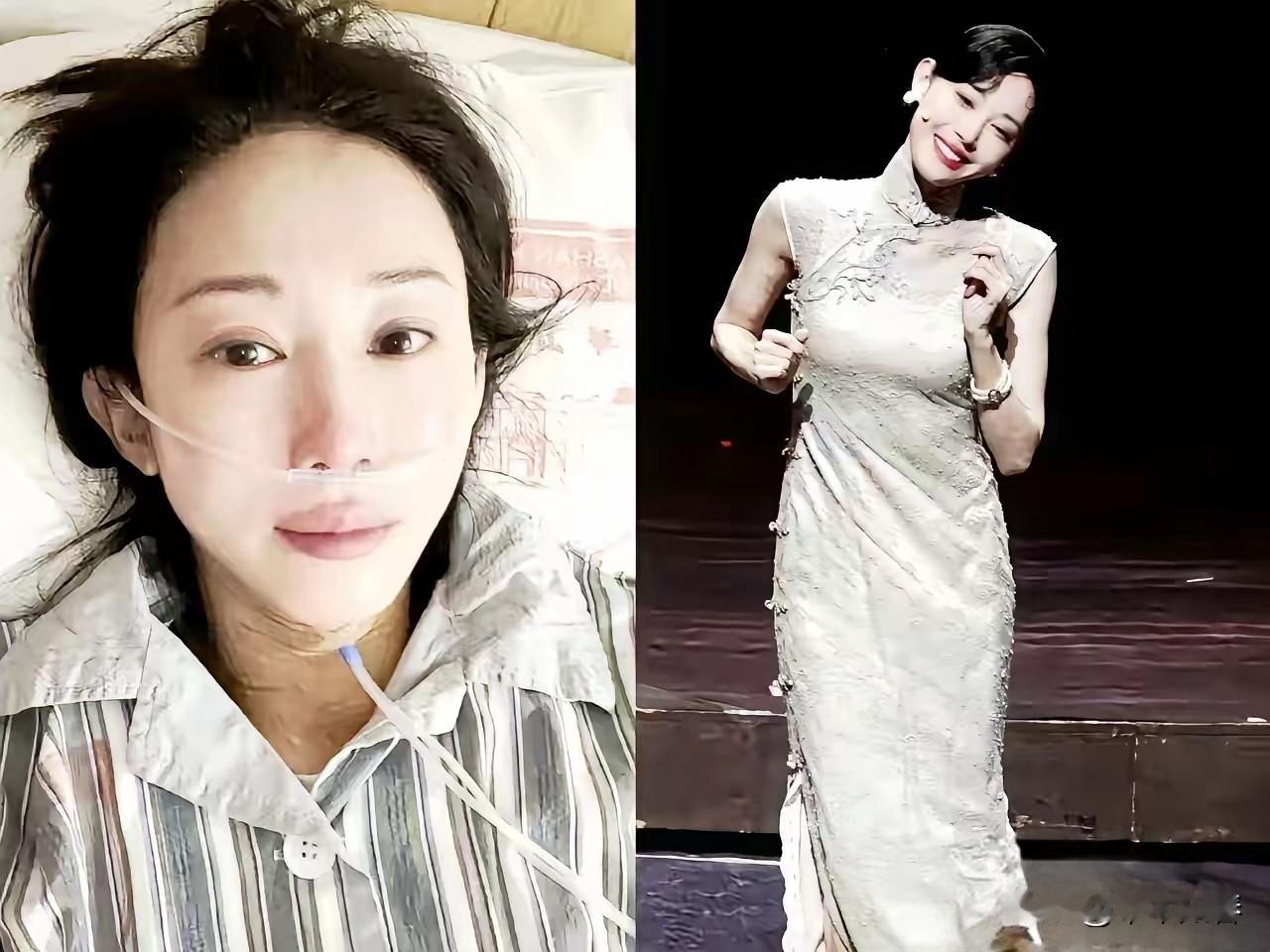 刚去查了朱洁静抗癌的经历。这不查不知道，一查被触动了。癌症线索，是前男友发现的。
