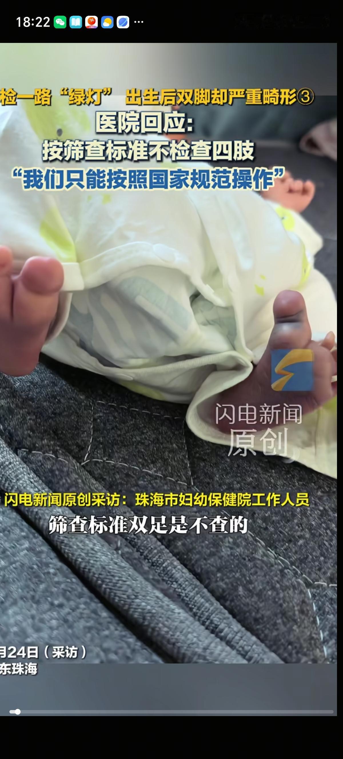 广州珠海一个刚生了孩子的产妇控诉自己在当地妇幼保健院花上万元产检，生的孩子双脚严