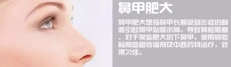 山西惠民耳鼻喉专家: 要认清鼻甲肥大