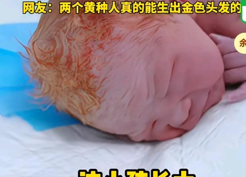 胎里就染好头发，出生的宝宝，头发金黄金黄的，家人看到后说这小孩长大得跟外国小孩似